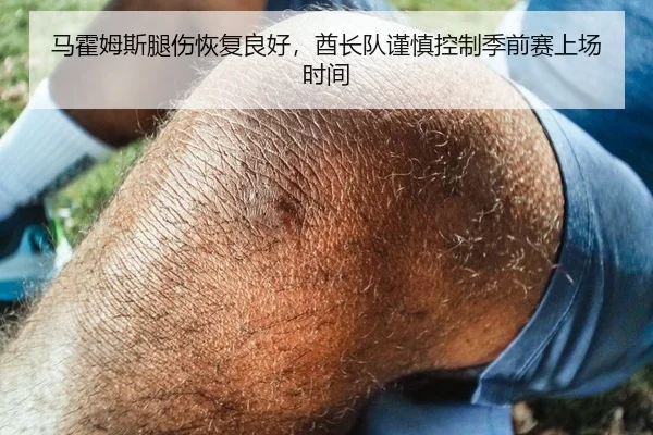 马霍姆斯腿伤恢复良好，酋长队谨慎控制季前赛上场时间